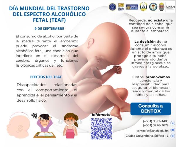 Sindrome alcoholico fetal